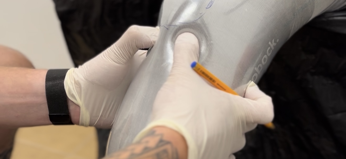 Как выбрать центр протезирования: 5 пунктов, на которые нужно обратить внимание