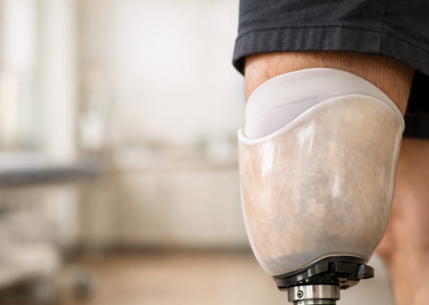 Почему индивидуальная гильза важнее любых дорогих модулей